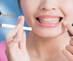 تنظيف الأسنان للمدخنين: كيف تحافظ على ابتسامة صحية في دبي